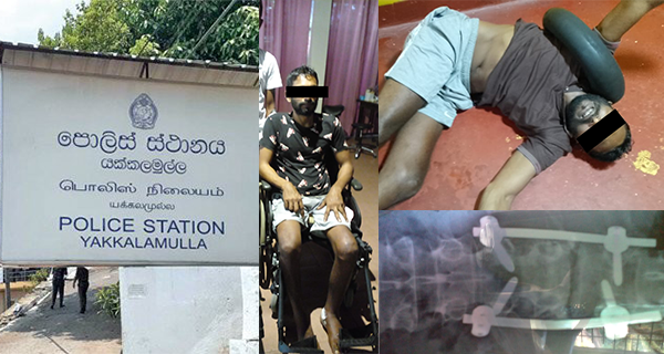 යක්කලමුල්ල පොලිසිය, ආබාධිතයෙකුට පහරදෙයි!